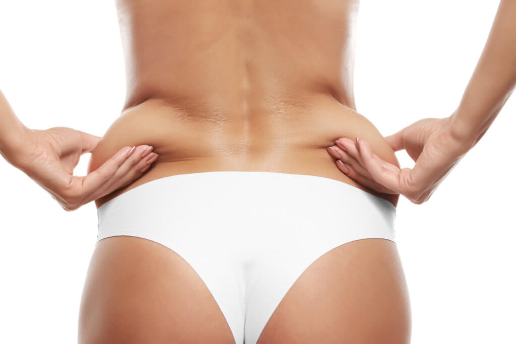 Liposuction, CoolSculpting, and More: Comparing the Cost of Fat Procedures